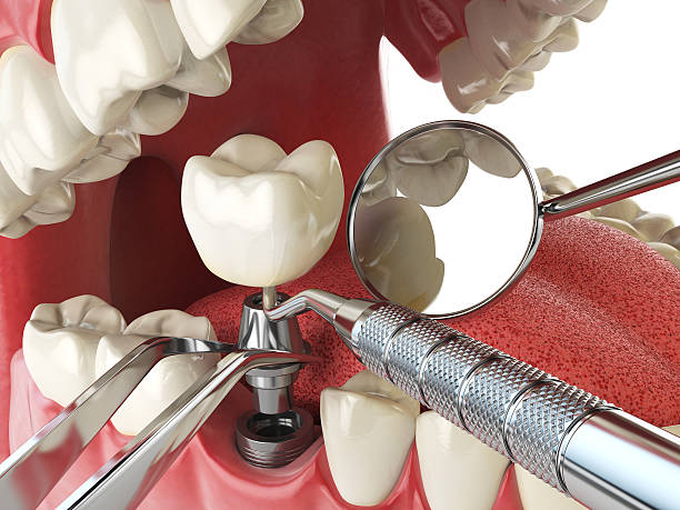 Best Emergency Treatment for Oral Infections in Elburn, IL